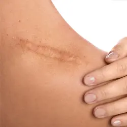 Ergotherapie - Hand